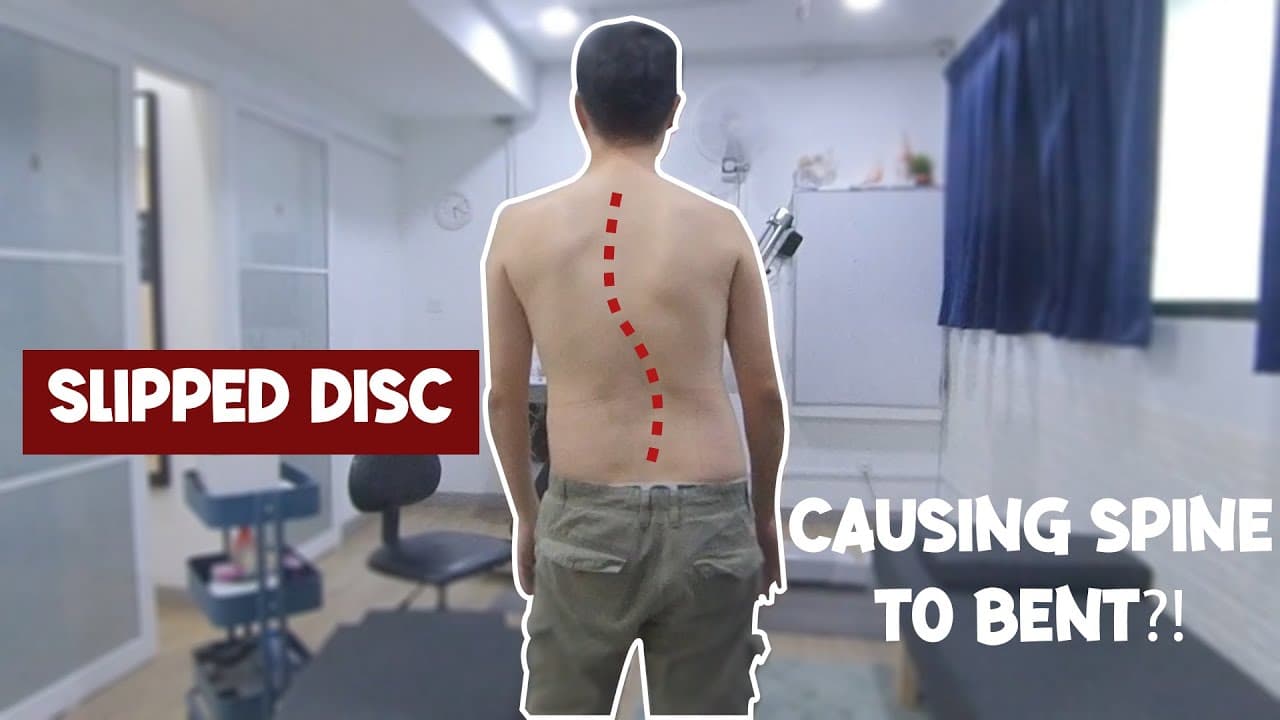 Slipped Disc — Body Slanted to One Side — Bewell Chiropractic Singapore